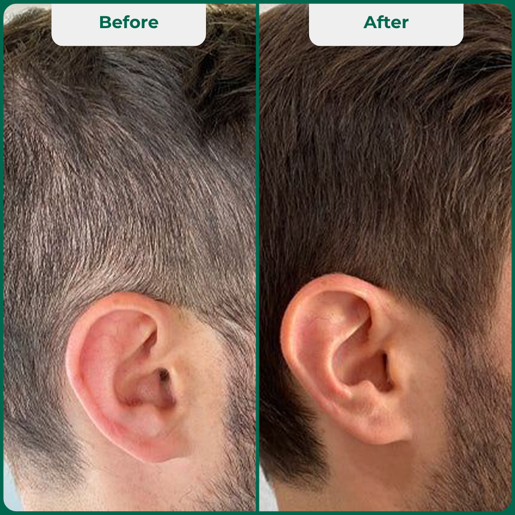 Bionuara Activation Pack