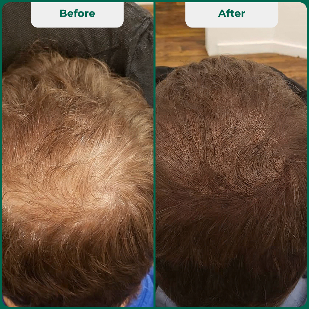 Bionuara Activation Pack