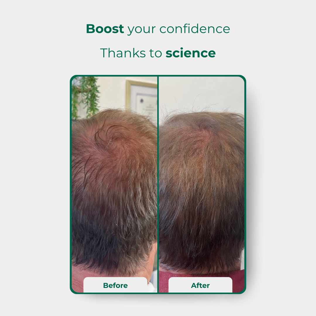 Bionuara Activation Pack