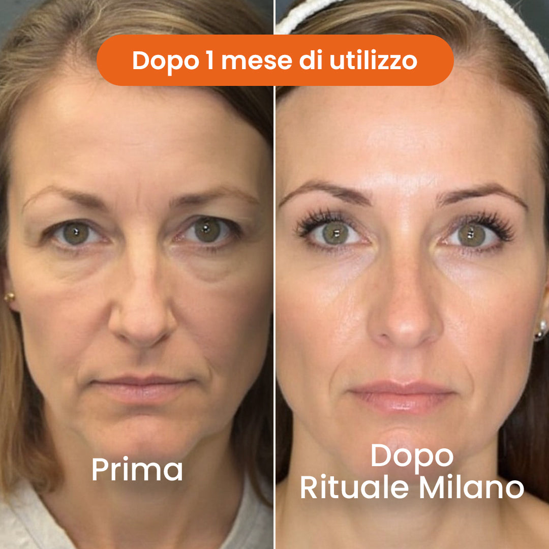 Il Sistema di Micro-Infusione