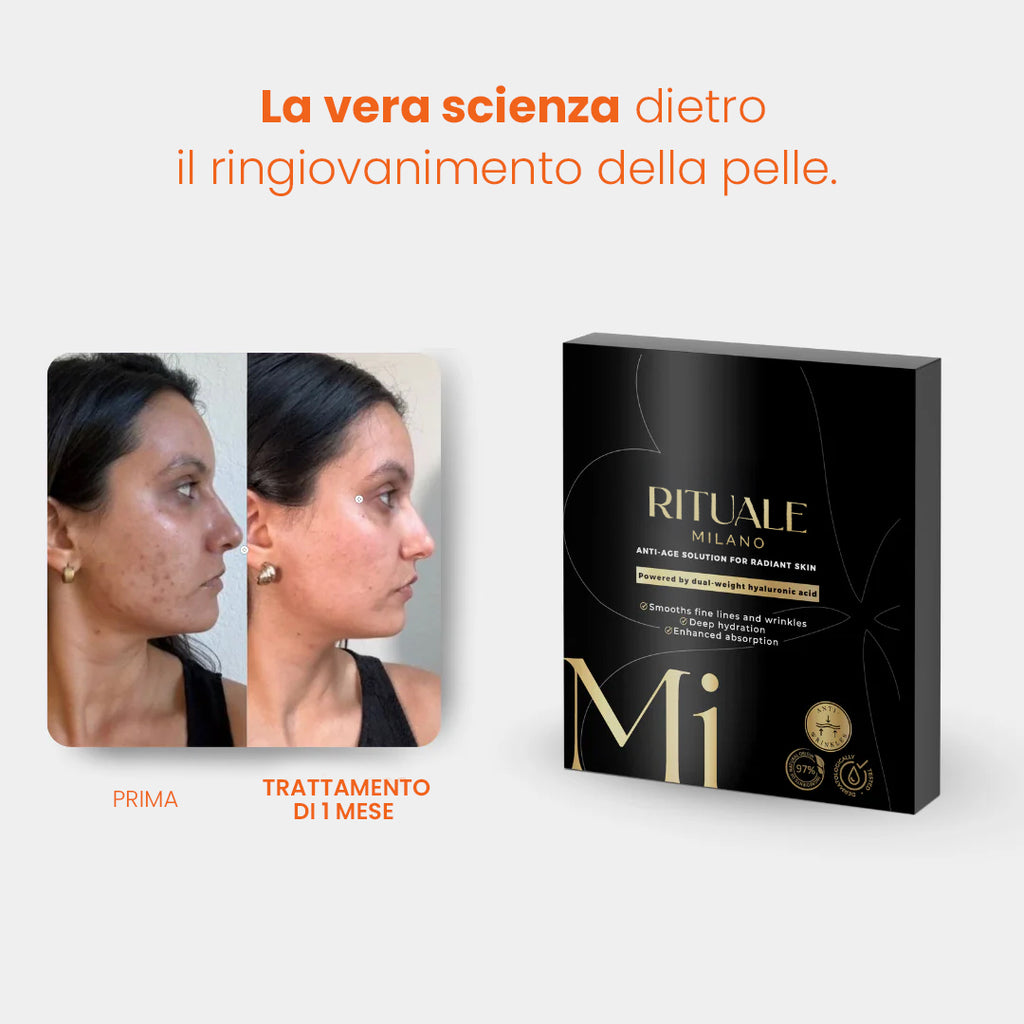 Il Sistema di Micro-Infusione