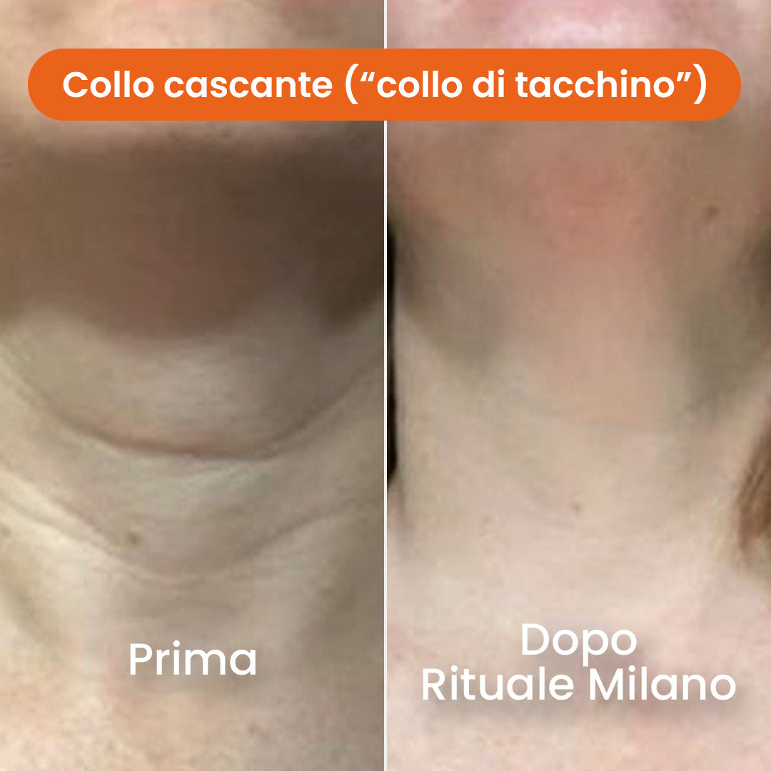 Il Sistema di Micro-Infusione