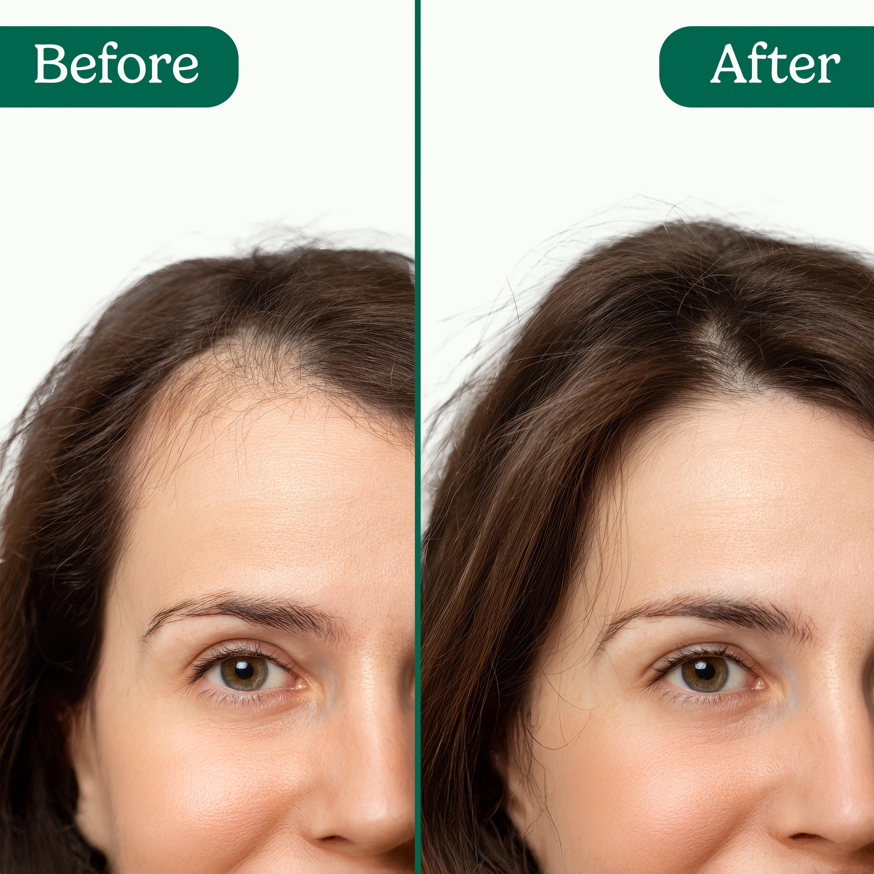 Sistema di attivazione follicolare Bionuara 