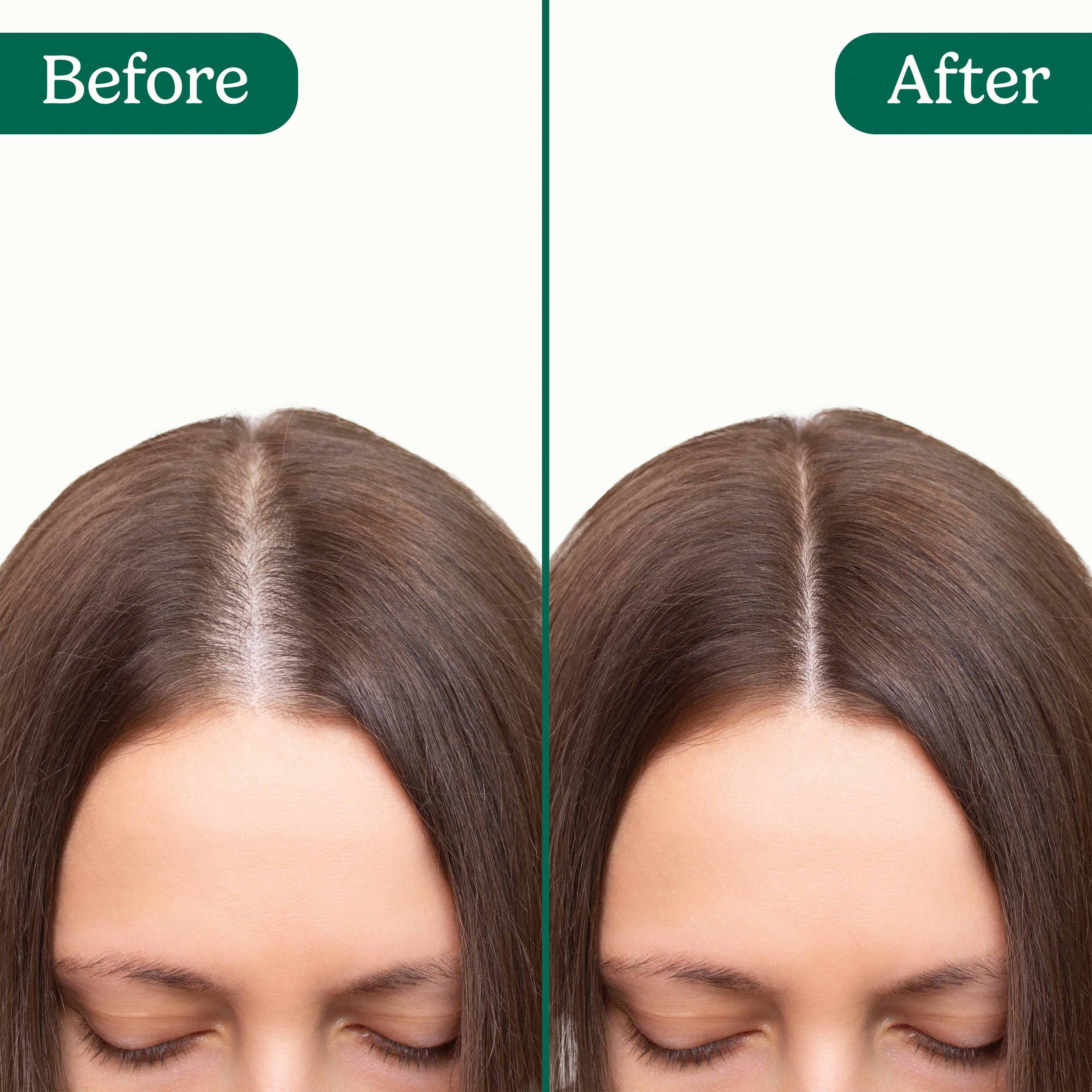 Sistema di attivazione follicolare Bionuara 